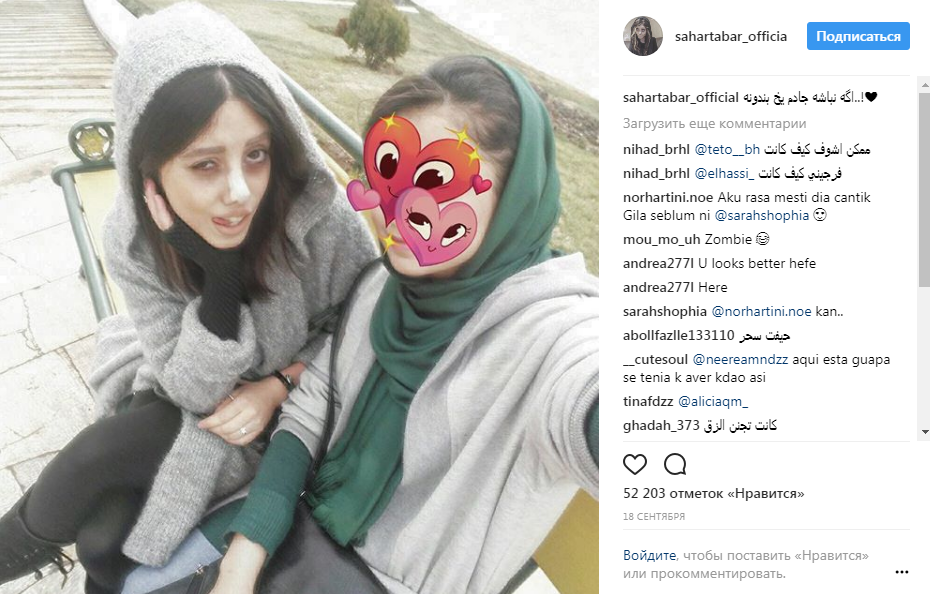 Стало известно, как выглядела до операций подражательница Джоли